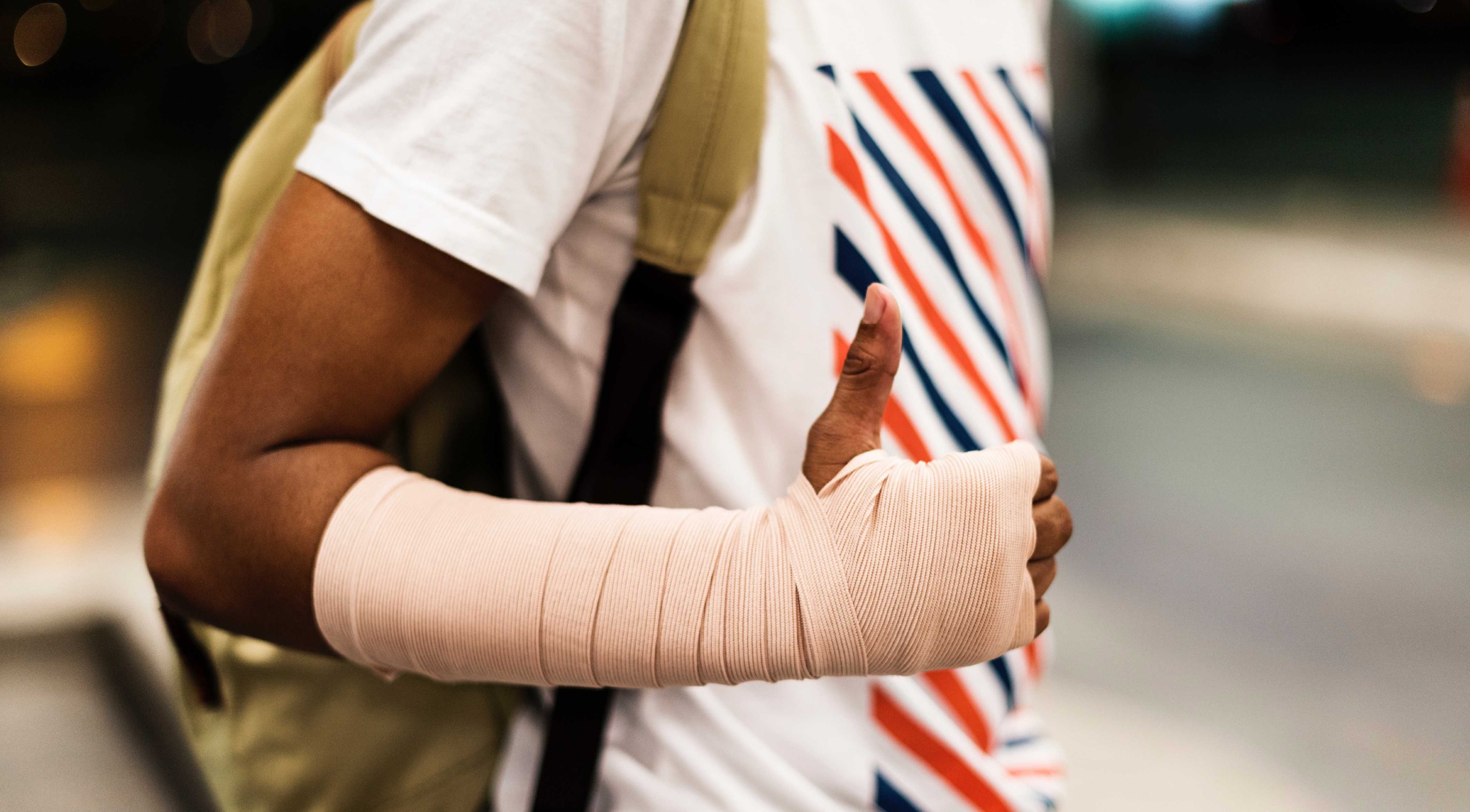 Close-up van een gebroken arm van een gebruiker van de incident rapportage app.